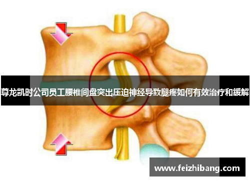 尊龙凯时公司员工腰椎间盘突出压迫神经导致腿疼如何有效治疗和缓解